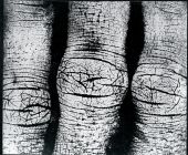 Epidermic Scapes, 1977, Vera Chaves Barcellos (VCB)